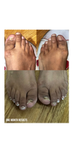 Load image into Gallery viewer, GOTUFUNGAL Anti-fungal Oil Treatment